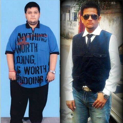 01 before-after-bariatric